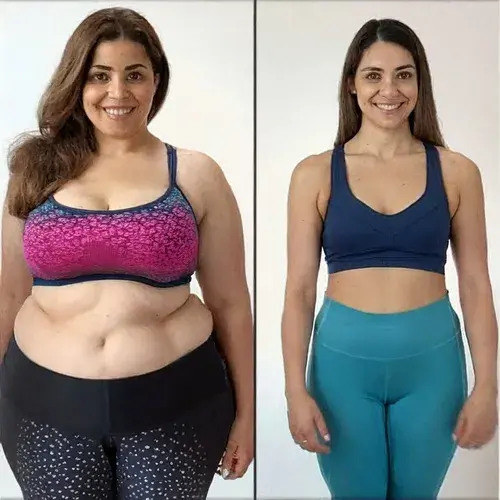 Firefly-antes-e-depois-mulher-gorda-x-magra-emagrecimento-51889